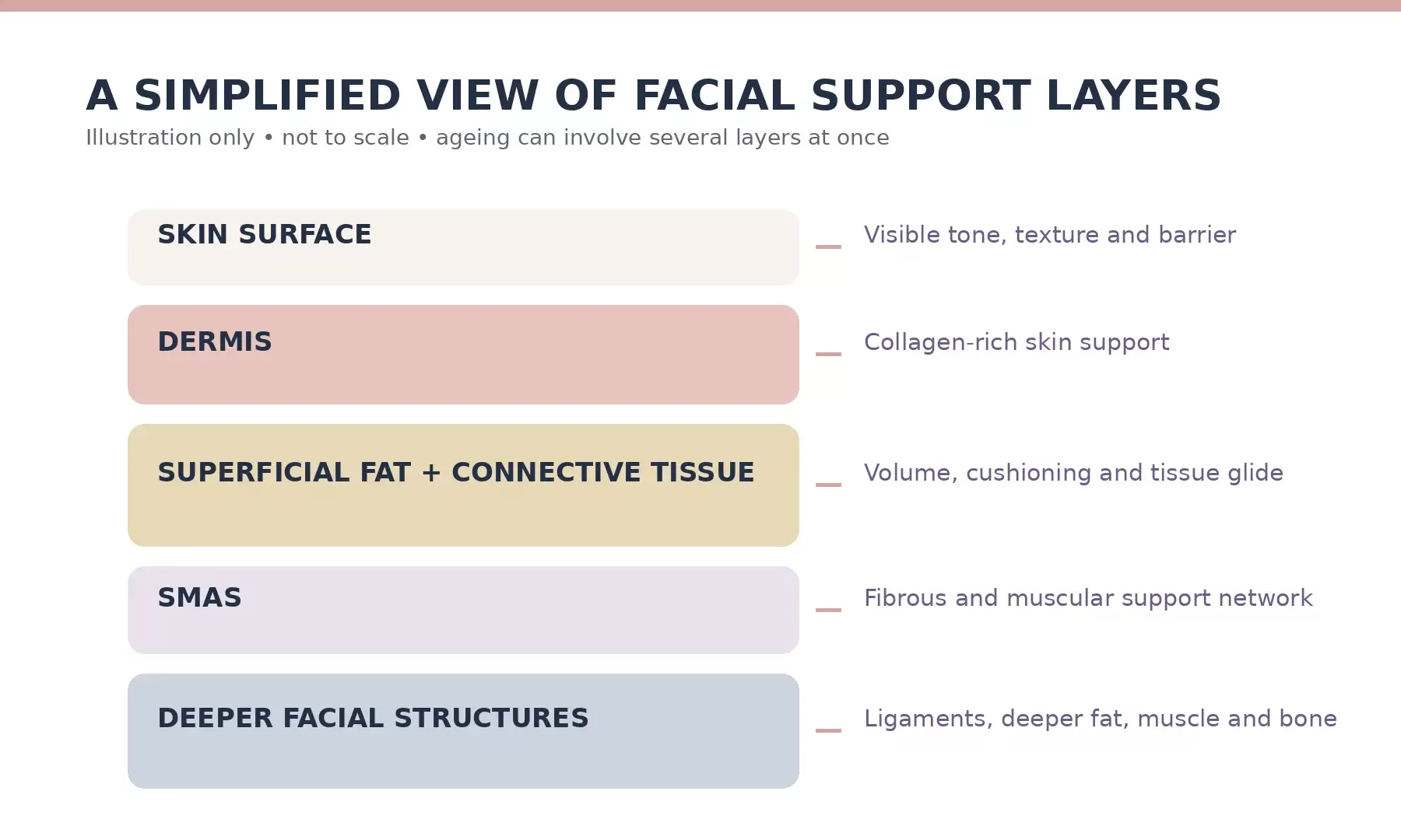 A simplified overview of facial support layers. Illustration only; not to scale.