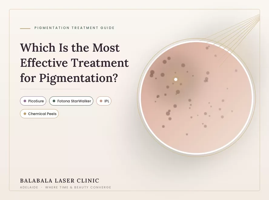 Which treatment is the most Effective treatment for Pigmentation: PicoSure, Fotona StarWalker, IPL or Peels?