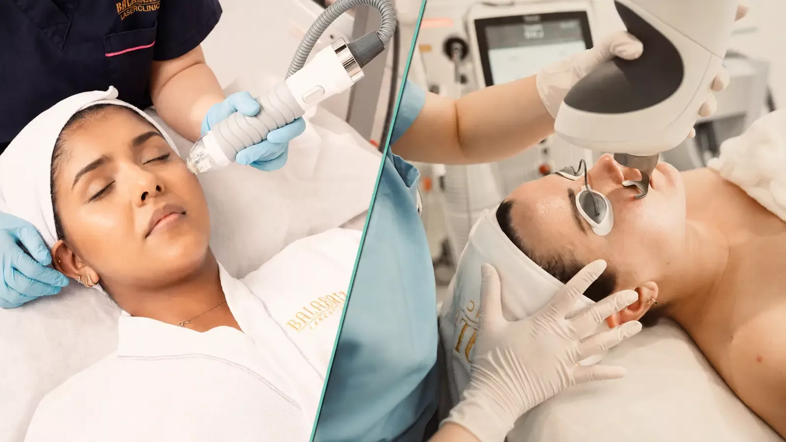 RF Microneedling vs Fractional Laser for Acne Scars: Which Is Better for Your Skin?