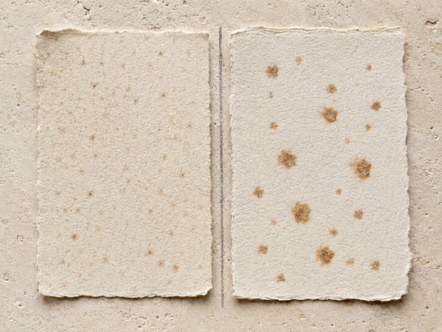 Editorial pattern study: fine seasonal freckles compared with larger, persistent solar lentigines.
