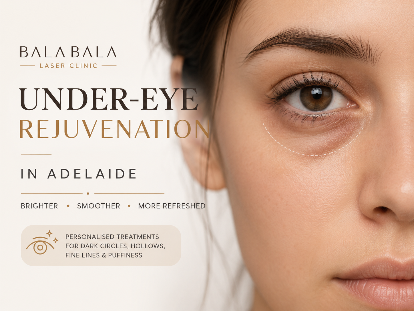 Under-Eye Rejuvenation Adelaide: Treatments for Dark Circles, Hollows, Fine Lines and Tired Eyes