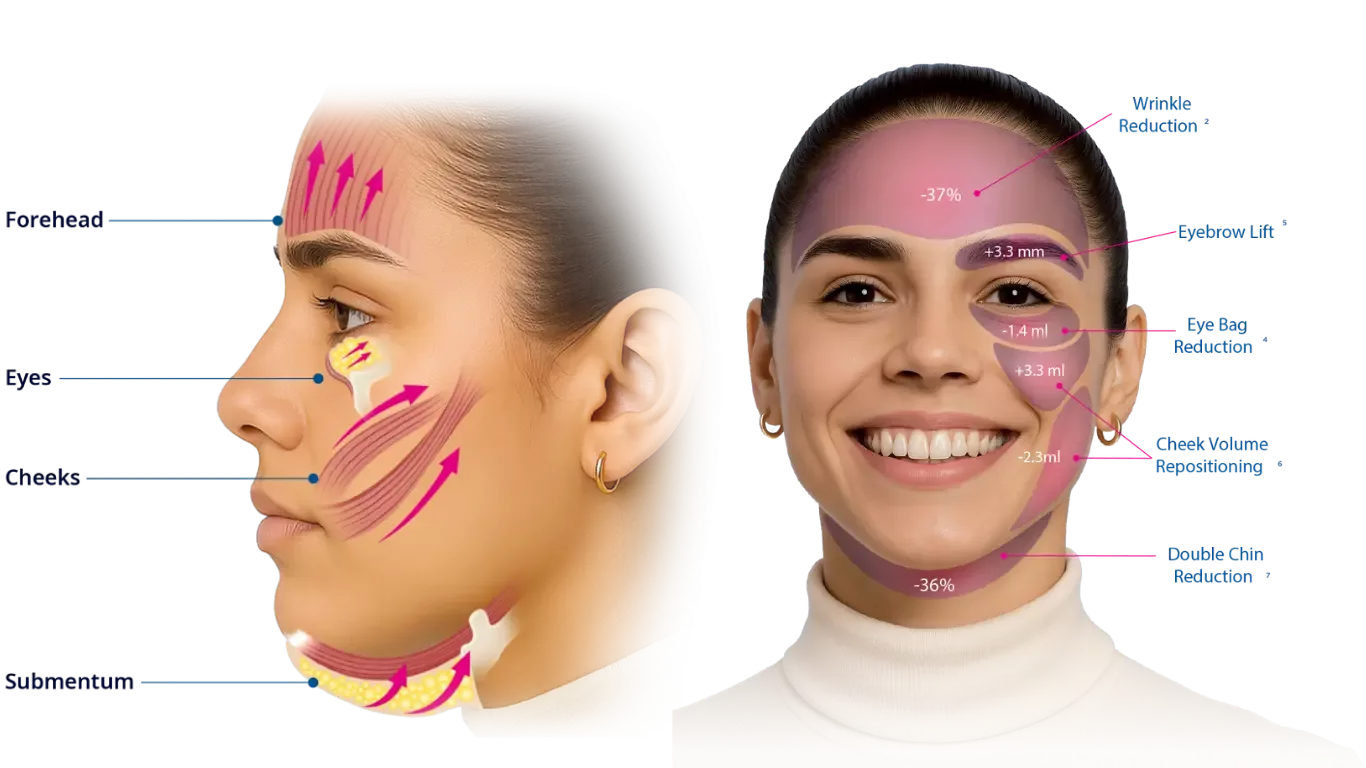 how dose EMFACE work？