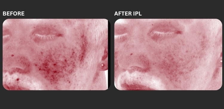 Icon IPL 4