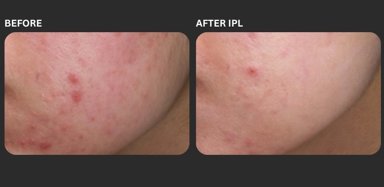 Icon IPL 5