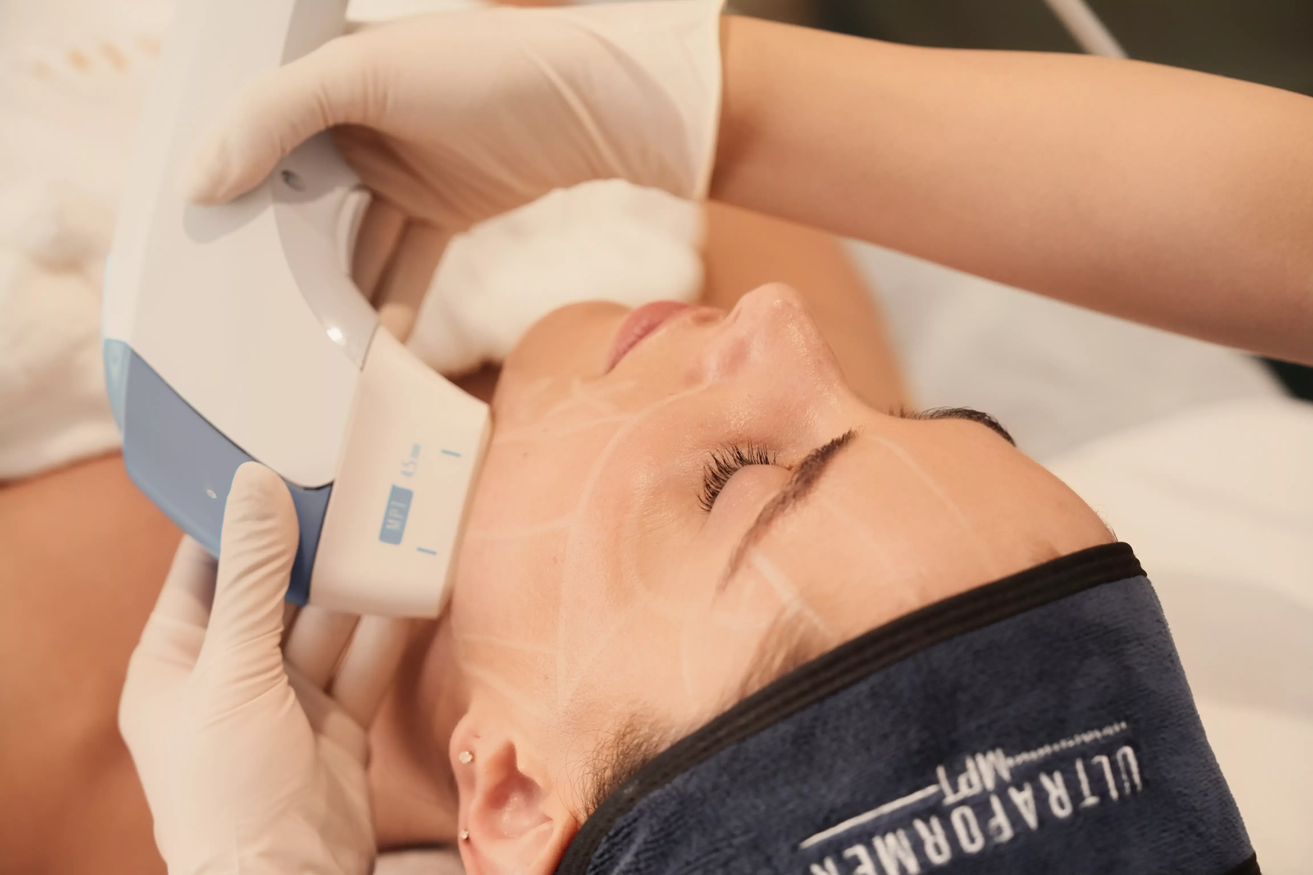 Ultraformer MPT – Advanced HIFU Technology