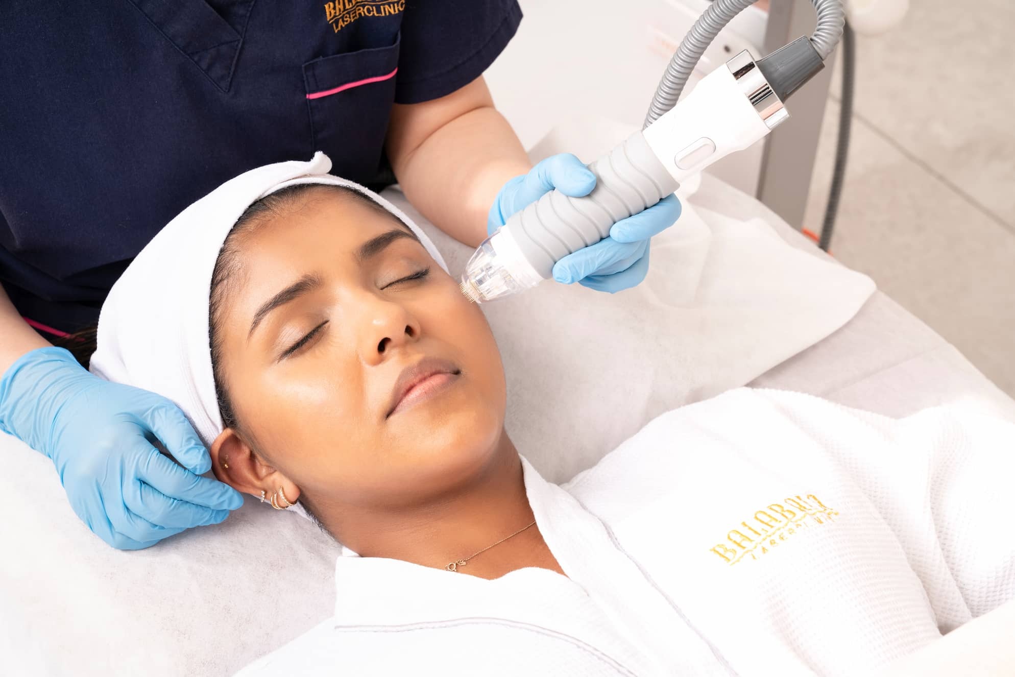 BalaBala Laser Clinc - Vivace Radiofrequency microneedling