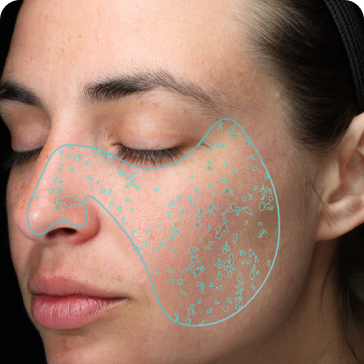 Book a free skin consultation