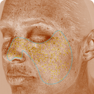 Bbd2af0fd858d29270329ef1fc2a2f26