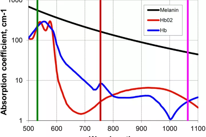 Laser Pigmentation Removal Adelaide: Best Treatment for Melasma & Dark Spots