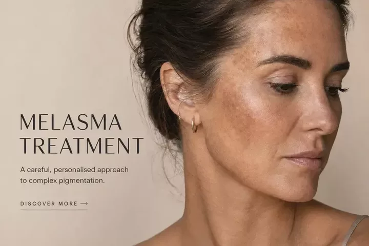 Melasma Treatment Adelaide: Why a Careful, Layered Plan Matters