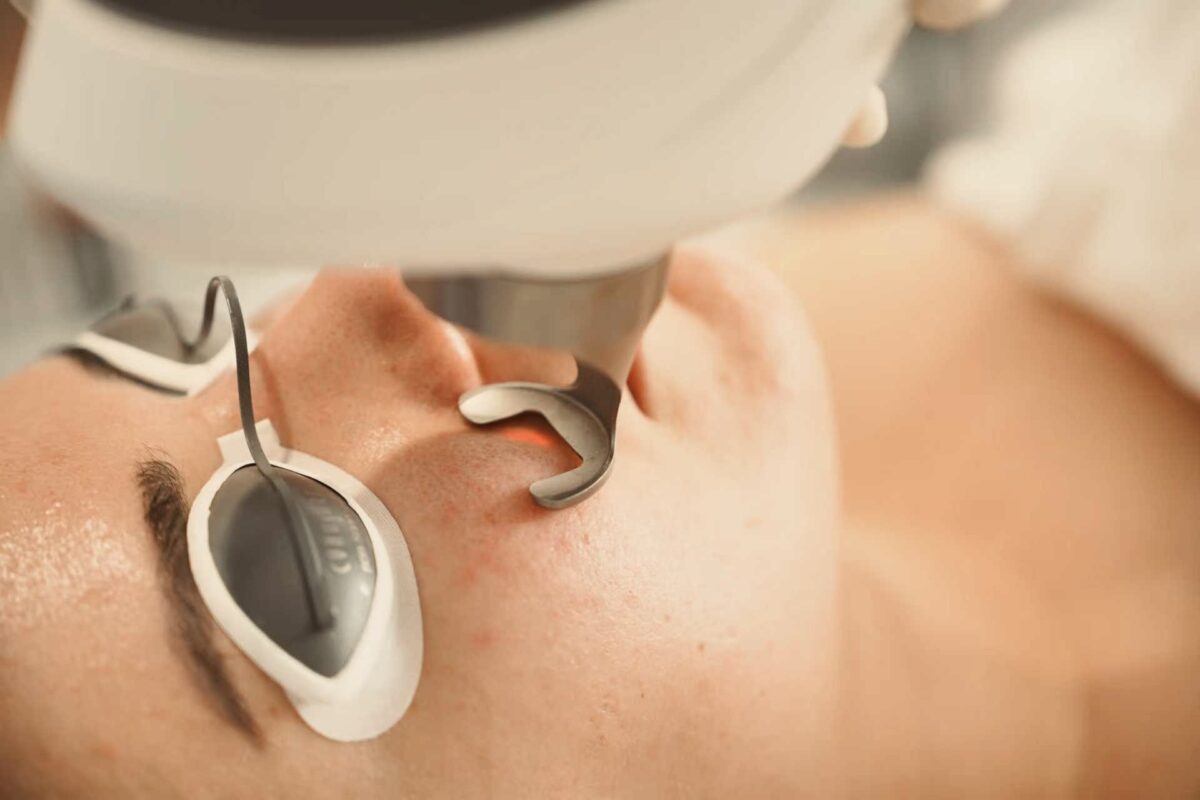 Fotona Acne & Acne Scar Revision Laser