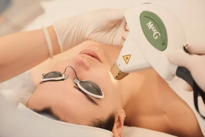 Is IPL Treatment Good for Your Face? Exploring Benefits, Risks & Results