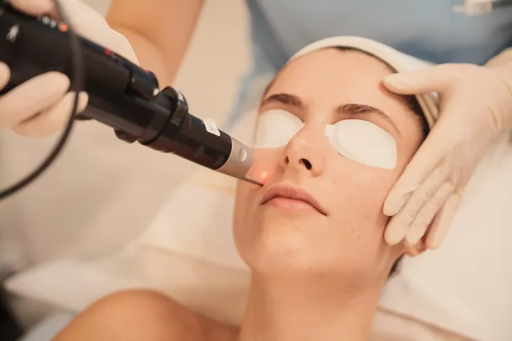 Laser Pigmentation Aftercare: How to Prevent Pigmentation Coming Back