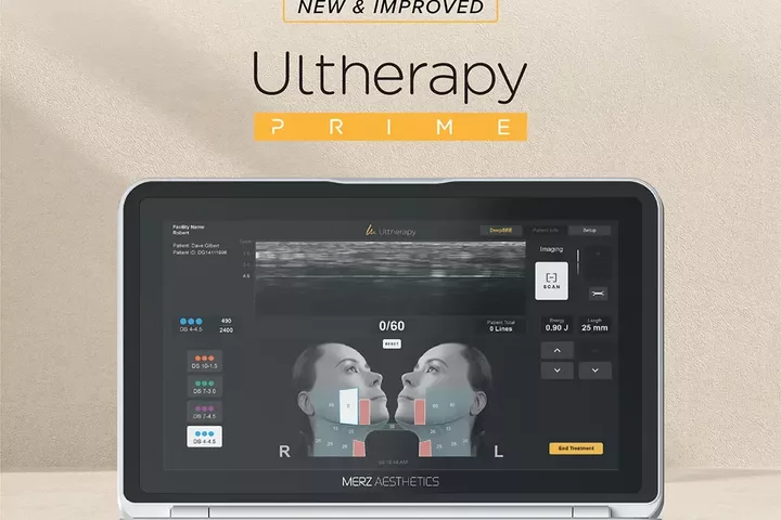 How Long Does Ultherapy Prime Last? (Longevity, Results & Maintenance Guide)