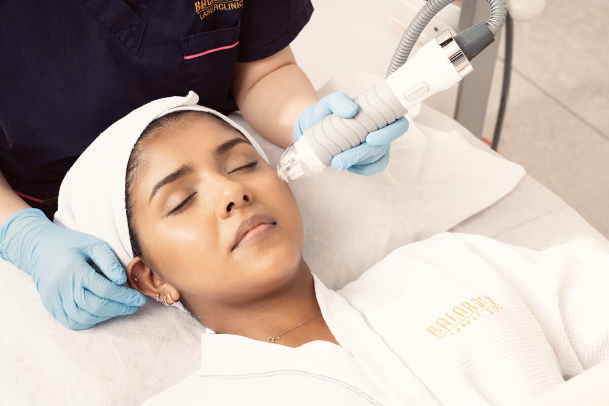 VIVACE RF Microneedling