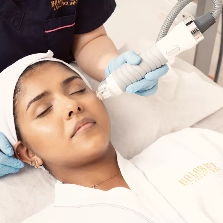 VIVACE RF Microneedling