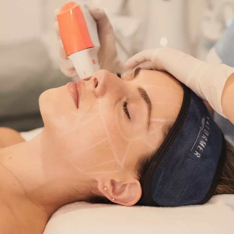 Ultraformer MPT （SMAS Skin Layer）