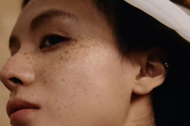 Does Pigmentation Go Away Naturally? Unpacking The Science