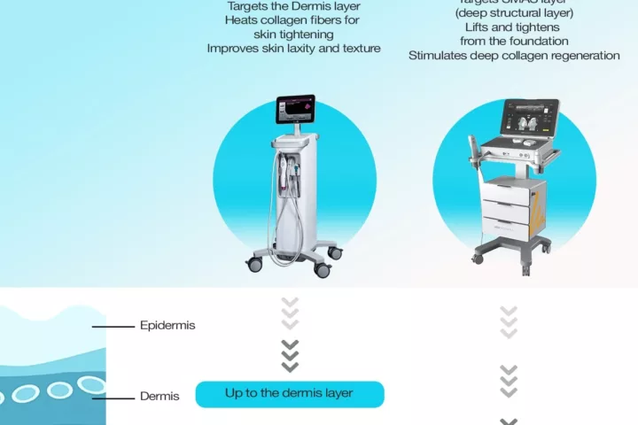 Thermage FLX vs Ultherapy Prime: Which Anti-Ageing Treatment Is Right for You?