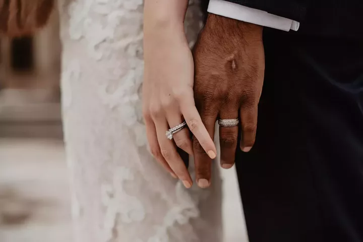 Pre-Wedding Skin Treatments - How to Get Ready by the Month