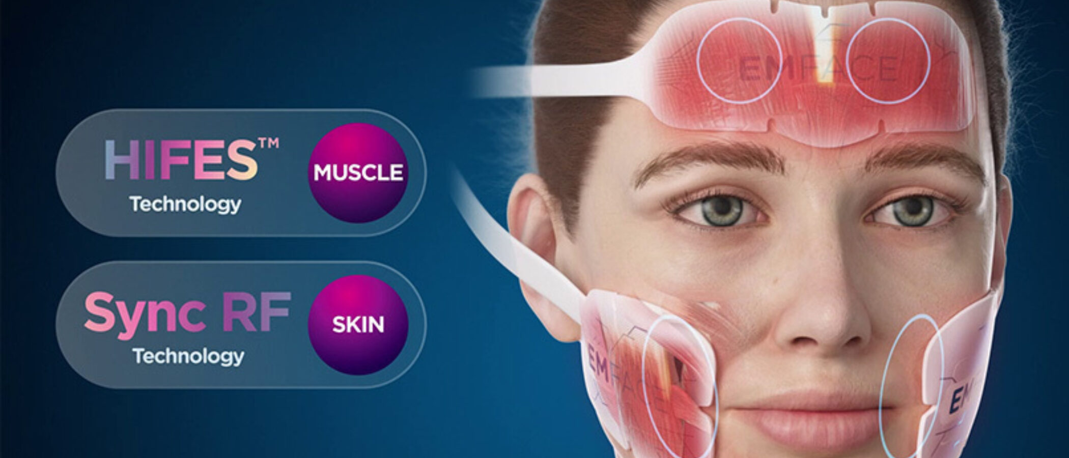 Emface vs Ultherapy (Treatment Comparison)